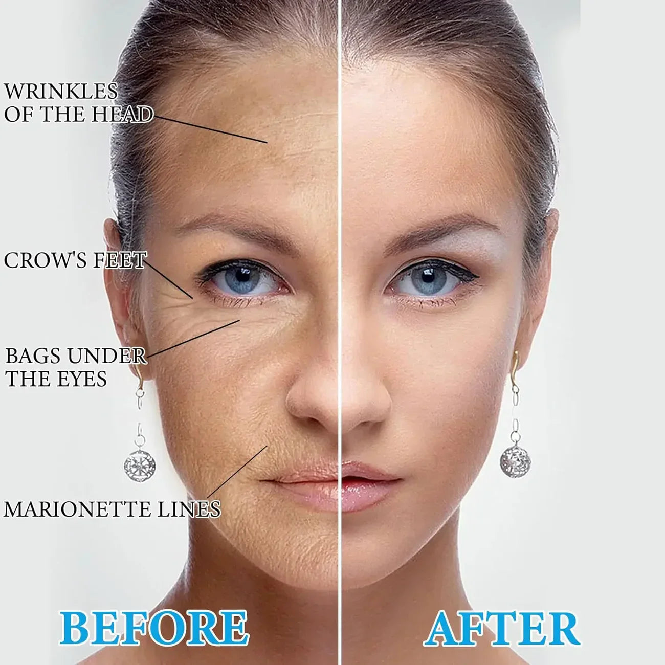 RenuevaSkin™ Reafirma y reduce papada - Serum Botox con Colageno + ENVÍO GRATIS 🇬🇹 🛒