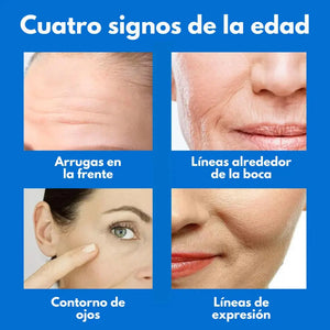RenuevaSkin™ Reafirma y reduce papada - Serum Botox con Colageno + ENVÍO GRATIS 🇬🇹 🛒
