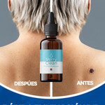 VerruClear™  Elimina Verrugas+ENVIO GRATIS 🚚