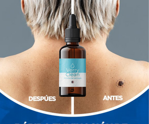 VerruClear™  Elimina Verrugas+ENVIO GRATIS 🚚
