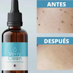 VerruClear™  Elimina Verrugas+ENVIO GRATIS 🚚