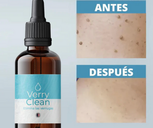 VerruClear™  Elimina Verrugas+ENVIO GRATIS 🚚